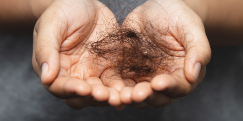 Ayurvedic hair fall treatment in delhi