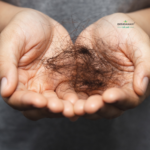 Flat lay of Ayurvedic herbs like Amla, Bhringraj, Neem, and a bowl of herbal oil with a wooden comb, symbolizing natural remedies for hair fall management.