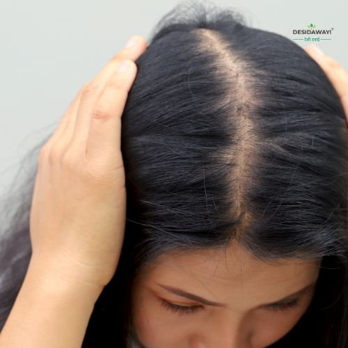 Top 5 herbs for hair fall treatment
